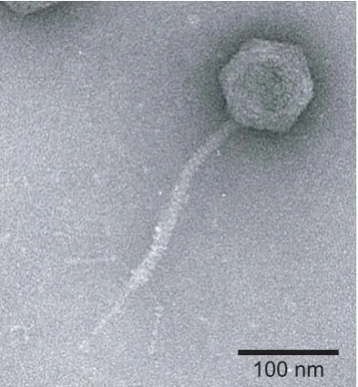 Figure 6.2: Electron microscopy image of a T5 phage virion. Image taken at theInstitut de Biochimie et Biophysique Moleculaire et Cellulaire, UMR, CNRS at Uni-versit´e Paris Sud