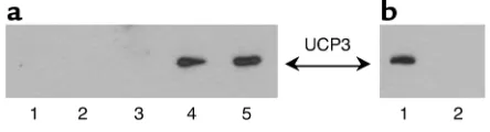Figure 1(a) Representative Western blot of human lung (1), human liver (2),human white adipose tissue (3), and two human vastus lateralis mus-cle samples (4 and 5) after loading similar amounts of protein