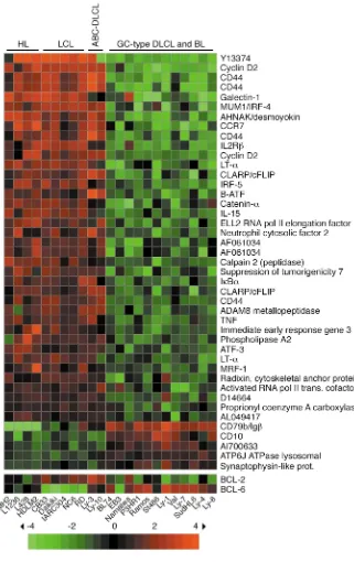 Figure 2Identification of genes differentiallyexpressed between HL lines, LCL,and ABC-type DLCL lines versus BLand GC-type DLCL