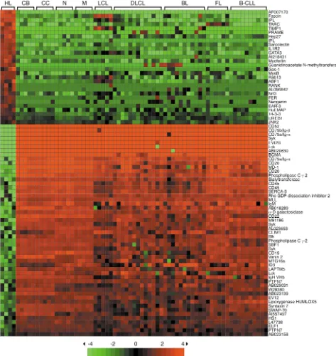Figure 3Identification of genes specifically expressed or downregulated in HL cell lines