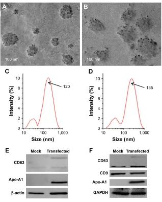Figure 2 characterization of exosomes.Notes: (A, B) TeM micrographs of apo-exo before and after loading with mir-26a, respectively