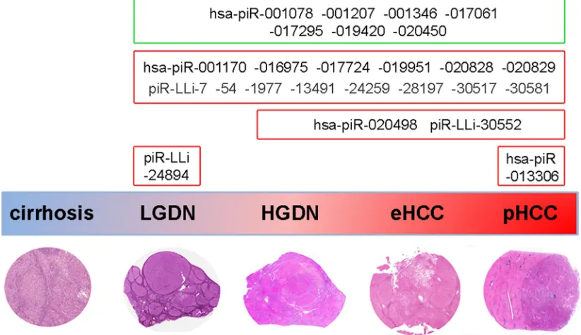 Figure 4: Overview of piRNA expression changes during human liver carcinogenesis. The scheme summarizes the main results of piRNA and piRNA-like expression changes detected at different steps of human hepatocarcinogenesis