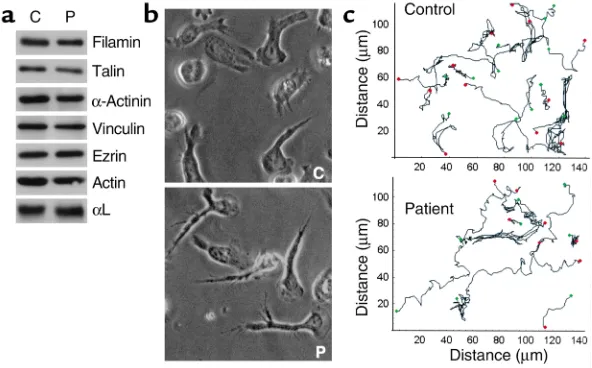 Figure 7Comparison of the affinity and avidity state of integrins. (