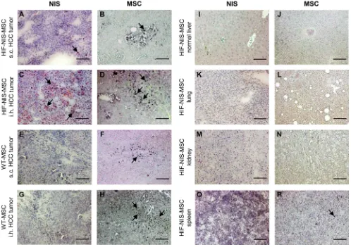 Figure 3: MSC recruitment and hypoxia-induced NIS expression were higher in intrahepatic compared to subcutaneous HCC tumors