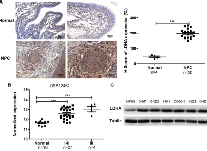 Figure 4: LDHA is overexpressed in NPC tissues and cell lines. (A) IHC analysis of LDHA protein expression in NPC and non–tumor nasopharyngeal epithelial tissues (normal)