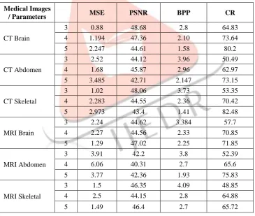 Table 2 Performance Analysis at Different Decomposition Level using Haar Wavelet   