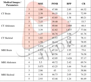 Table 3 Performance Analysis at Different Decomposition Level using Daubechies Wavelet 