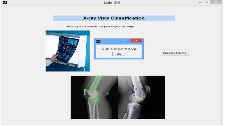 Fig. 5 Snapshot of X- ray view classification system 