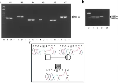 Figure 1Deletion of dystrophin exon 45 in DMD-BMT1 genomic DNA by PCR. (a) DNA amplification performed using primers to dystrophin exons