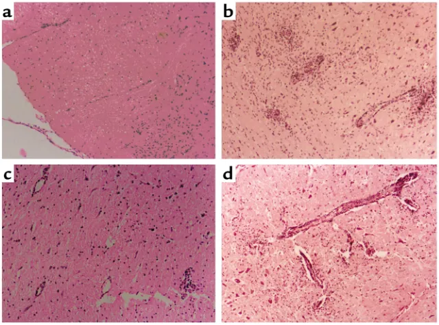 Figure 2(with MBPp87–99/CFA to induce activeEAE, the lower lumbar region of thespinal cord of EAE rats that were not sub-jected to soluble peptide therapy (subjected to therapy with solubleMBPp68–86 (with soluble MBPp68–86, and then withneutralizing Ab’s t