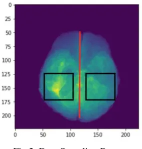 Fig 1. (a) Actual Data Distribution. (b) Normalized data (b) Distribution. 
