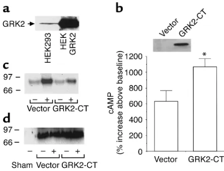 Figure 1Expression of the GRK2-CT enhances PTH/PTHrP receptor responsive-