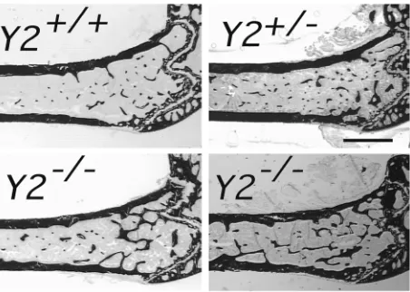 Figure 3Effect of germline Y2 receptor deletion on tra-15–17 weeks of age. Values are mean ± SD of fiveto eight mice per group