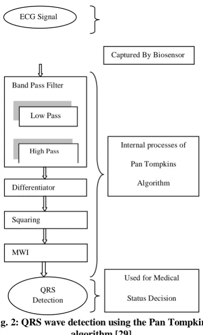 Fig. 2: QRS wave detection using the Pan Tompkins  algorithm [29] 