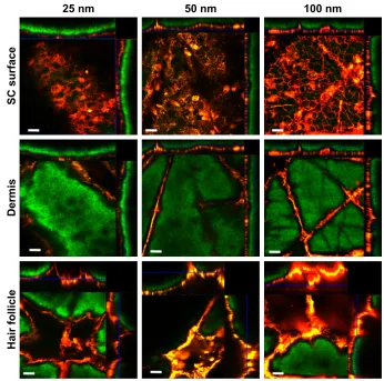 Figure 1 NPs of different size distributions in human skin.Notes: Three different-sized NP distributions are shown