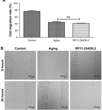Figure 7 Cell migration ability of aging RPE cells influenced in RP11-234O6.2 in vitro.Notes: (A) The graphs of each scratch test for 0 and 36 hours