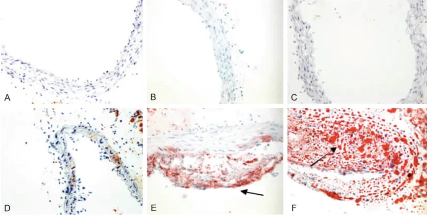 Figure 1. Aortic pathological changes (HE staining, ×200). A. 20-week-old control group; B