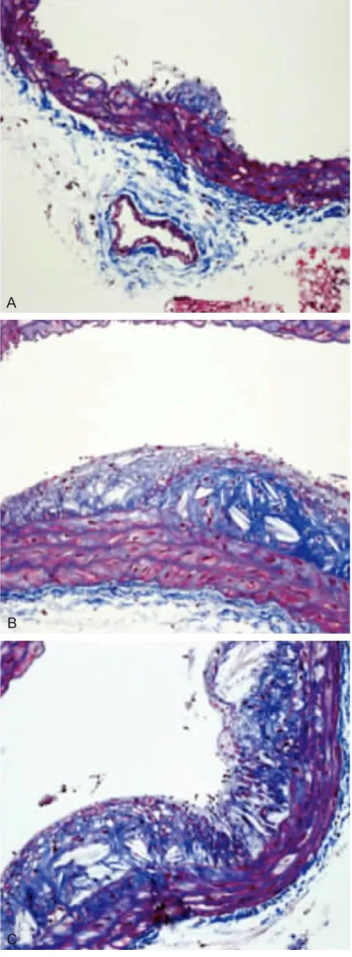Figure 3. Masson staining results (×200). A: 20-week-old model group; B: 27-week-old model group; C: 33-week-old model group.