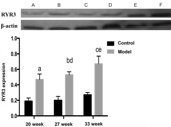 Figure 5. Aortic RYR3 expressions detected by Western blot. A. 20-week-old control group; B