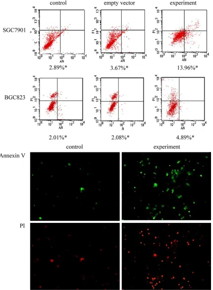 Figure 3. Apoptosis in gastric cancer cells overexpressing DAPPER1 Upper: The lower right quadrant is early apop-totic cells; upper right quadrant is late apoptotic cells