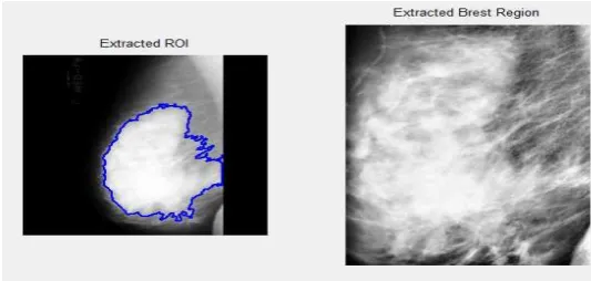Fig 3: ROI Extraction 