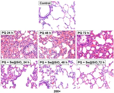 Figure 5 histological analysis of rat lung tissues.Note: The rat lung tissues were stained with hematoxylin and eosin.Abbreviation: PQ, paraquat.