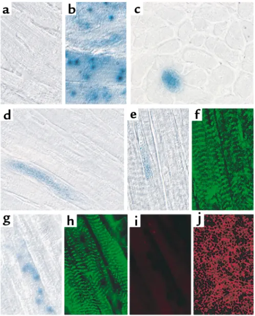 Figure 3Incorporation of SP cells into vascular endothelial cells. (