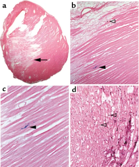 Figure 5LacZ staining occurs primarily at the border of myocardial infarc-