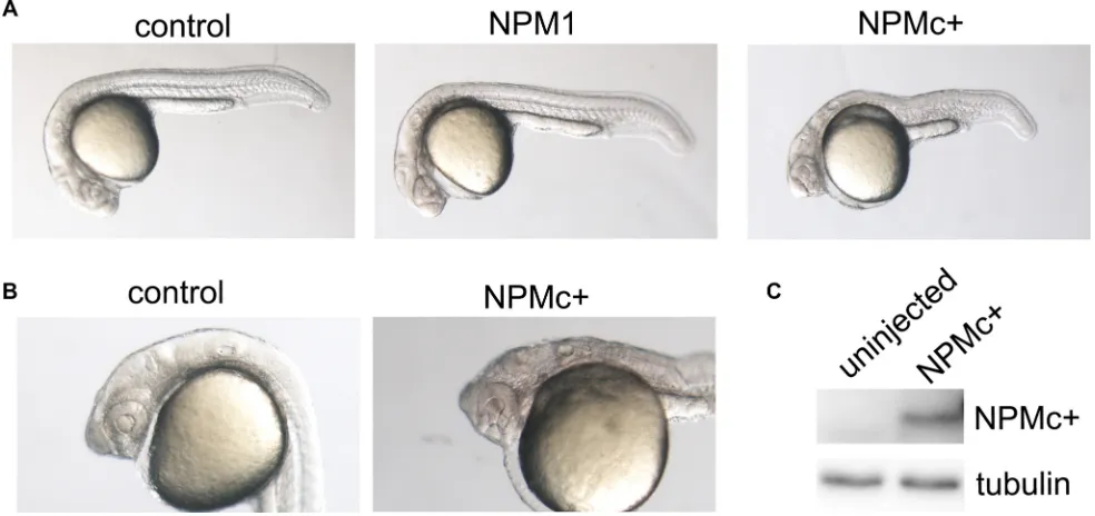 Figure 1: Embryo morphology after NPM1 and NPMc+ expression in zebrafish embryos. (A) Overall view of control (uninjected), NPM1 (90% of injected embryos showing the reported phenotype) and NPMc+ (85% of injected embryos showing the reported phenotype in m