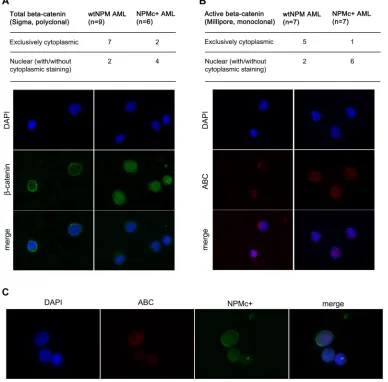 Figure 6: Analysis of β-catenin localization in AML patients. (A) Summary of results obtained with an antibody that recognizes total β-catenin (Sigma) and examples of staining patterns: cytoplasmic (left panels) and mostly nuclear (right panels)
