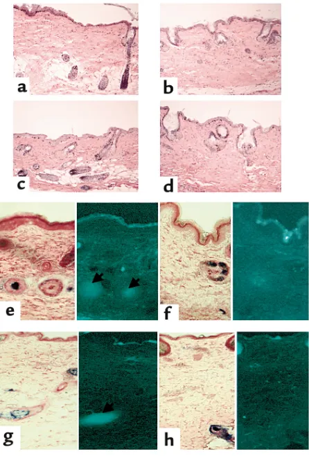 Figure 4Response of reconstituted follicles to anagen 7 weeks after implan-