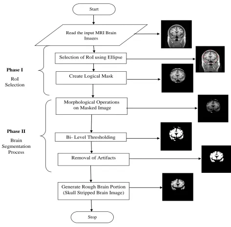 Fig. 1 Flowchart of TMOSMorphological closing is similar to dilation in which the boundaries of foreground regions are based on the 
