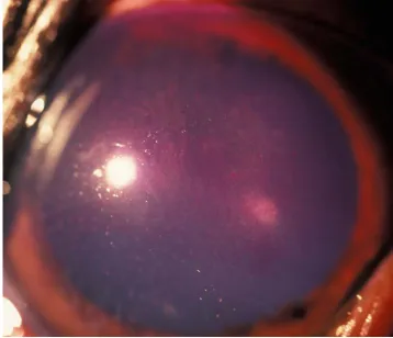 Figure 6: View of the cornea using oblique lighting 