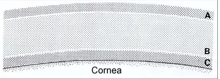 Figure 2: Precorneal tear film (PTF). A, Superficial lipid layer. B, Aqueous layer. C, Inner mucoid layer