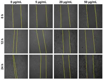 Figure 12 Percentage migration of 4T1 cells after 24 h treatment with 0, 5, 20 and 50 µg/ml seNPs.Notes: *P#0.05 vs control; **P#0.01 vs control.Abbreviation: seNPs, selenium nanoparticles.