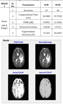 Table -1: Performance parameters calculations on the MR image with salt & pepper noise 