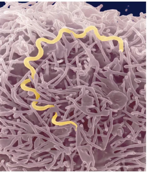 Figure 1T. pallidum