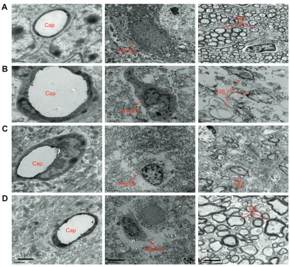 Figure 5 Histochemistry of cerebral infarction tissue. The cerebral hemispheres were cut in the coronal plane, the brain tissues were acquired from the identified ischemic core and paraffin embedded