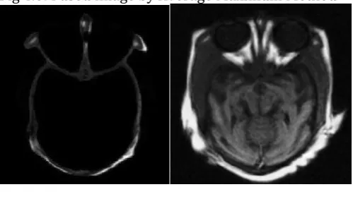 Fig 4.6: Fused Image by DWT with Haar and DBSS (2, 2) Method  