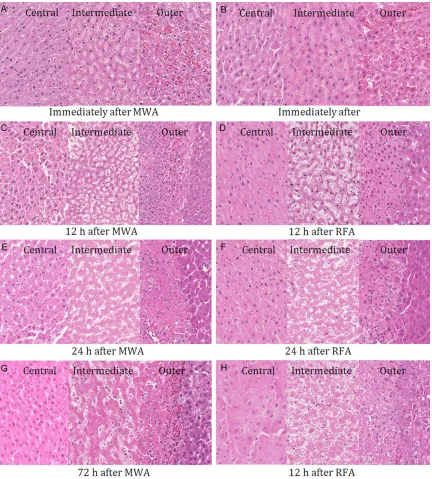 Figure 1. High magnification (400×) images of MWA and RFA samples stained with H&E. In the central zone, cells maintained their shapes, membranes, and nuclei at every time point after MWA (A, C, E, and G, left), whereas the cells progressively lost their s