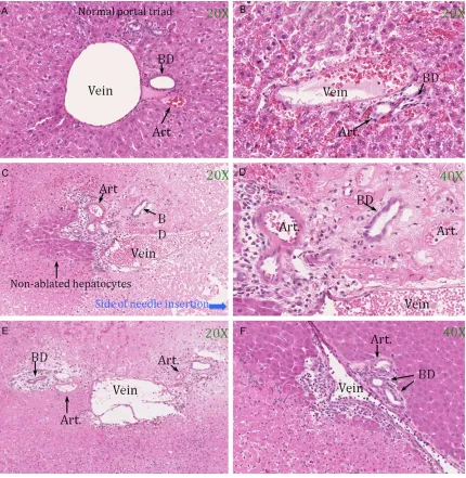 Figure 3. Changes of intrahepatic veins, arteries, and bile ducts in and around ablated regions