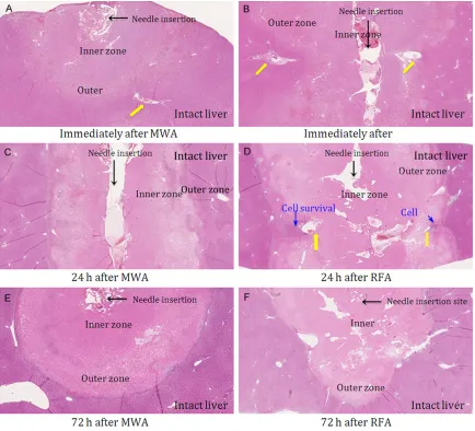 Figure 4. Low magnification (10×) images of MWA and RFA samples stained with H&E. Yellow arrows indicate blood vessels