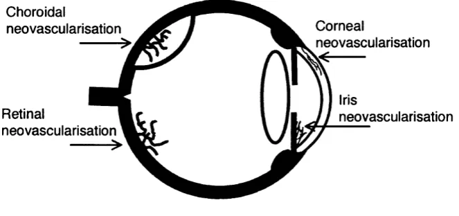 Figure 1.1 Schematic section of the eye showing common sites of intraocular 