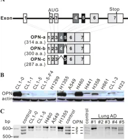 Figure 1: OPN expression in cell lines. A. Schematic diagram of OPN isoforms. OPN-a is the full-length isoform (314 a.a.), OPN-b lacks exon 5 (300 a.a.), and OPN-c is missing exon 4 (287 a.a.)