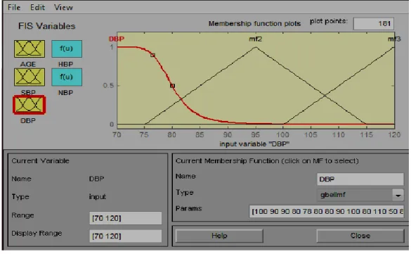 Figure 4: Fuzzy Hypertension DBP Membership Function 