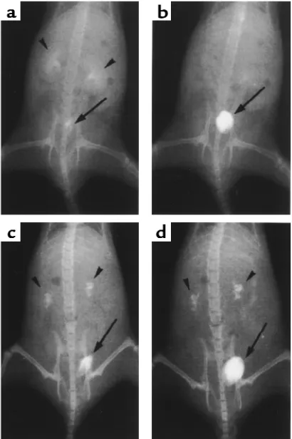 Figure 4Intravenous pyelography (