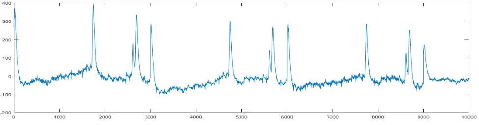 Fig. 1. Sample EEG data  