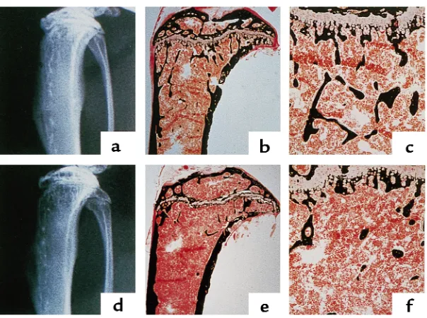 Figure 2Radiographic and histologic analysis of proximal tibiae from 11-week-old control and osteonectin-null mice