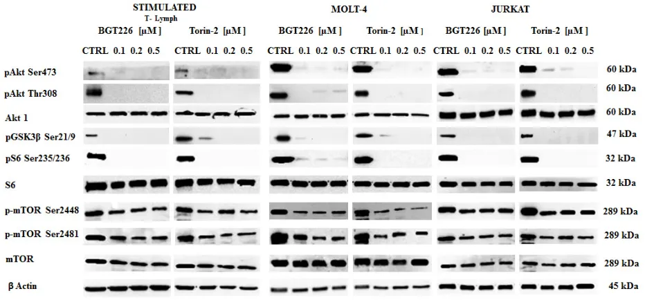 Figure 3: BGT226 and Torin-2 affect cell cycle in primary T lymphocytes, MOLT-4 and JURKAT cell lines