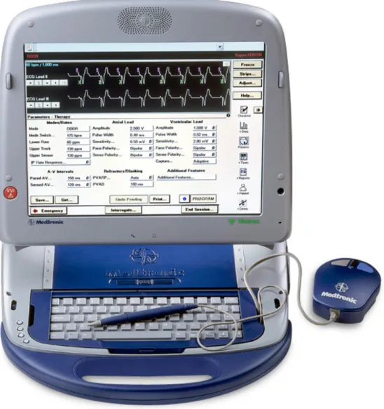 Figure 2.3. Example of an ICD computer programmer used to retrieve stored data and  electrograms, test atrial and ventricular leads, and program pacing and antitachycardia  therapy parameters